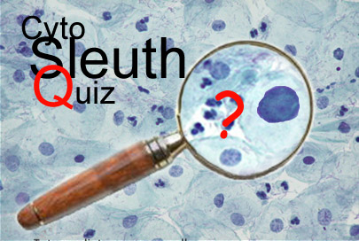 CytoSleuth Quiz